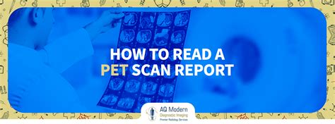 How to Read a PET Scan: A Journey Through the Labyrinth of Medical Imaging